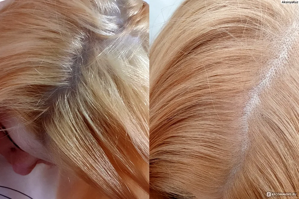Estel Essex toning