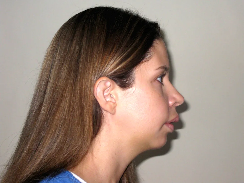 Brown-nosed girls