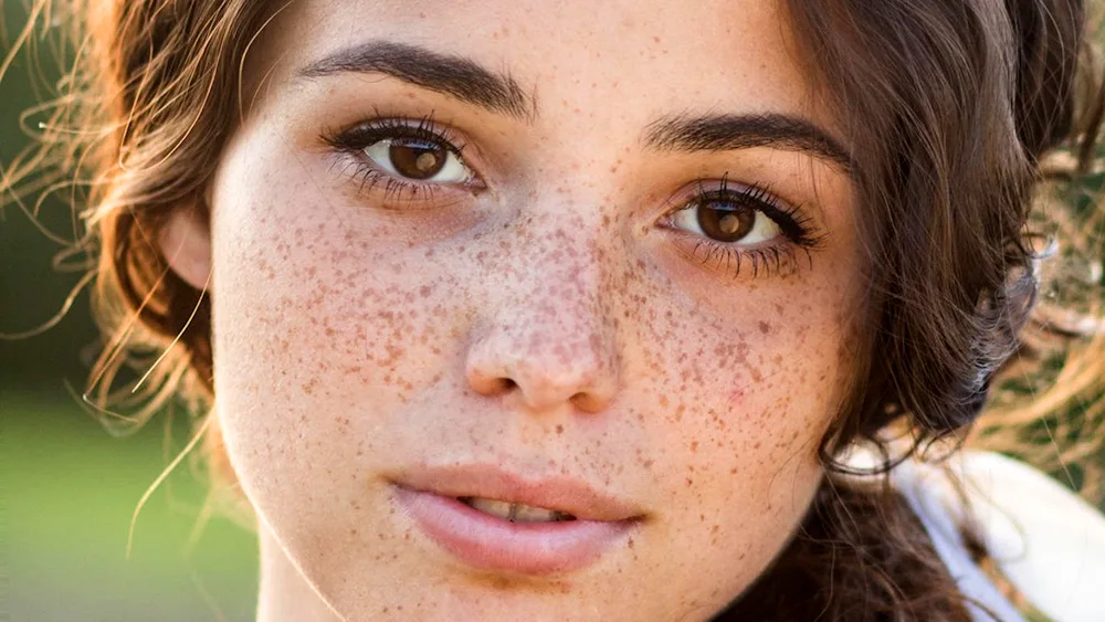 Svetlana Ivanova freckles