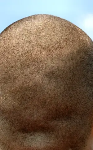 Bald men's head