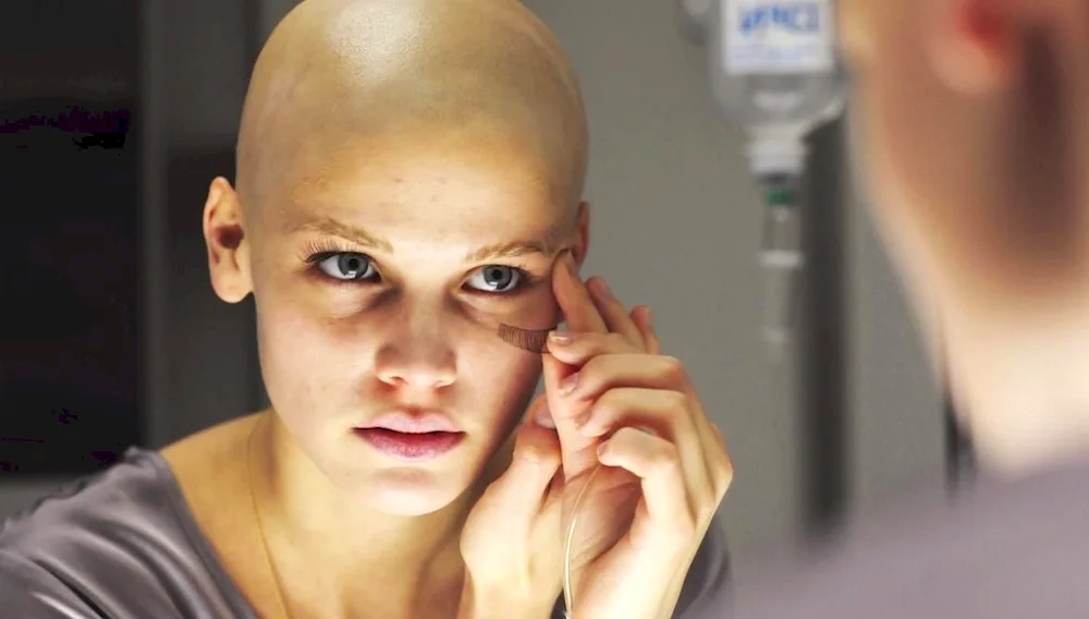 Hair after chemotherapy