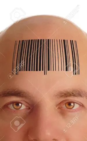 Baldness with bangs