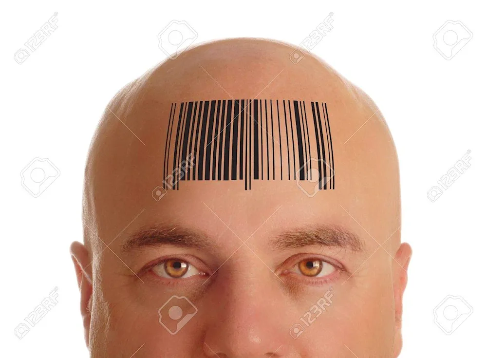 Baldness with bangs