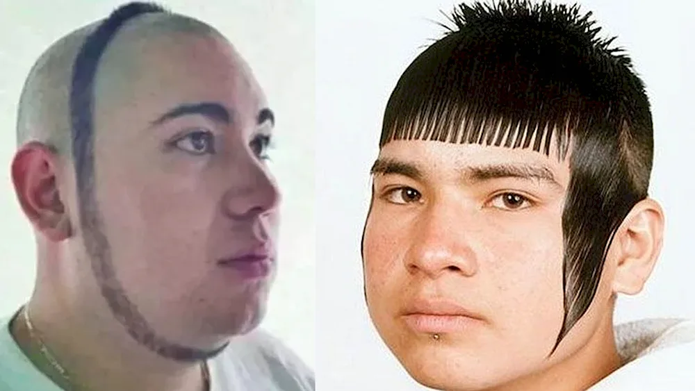 Bald with bangs