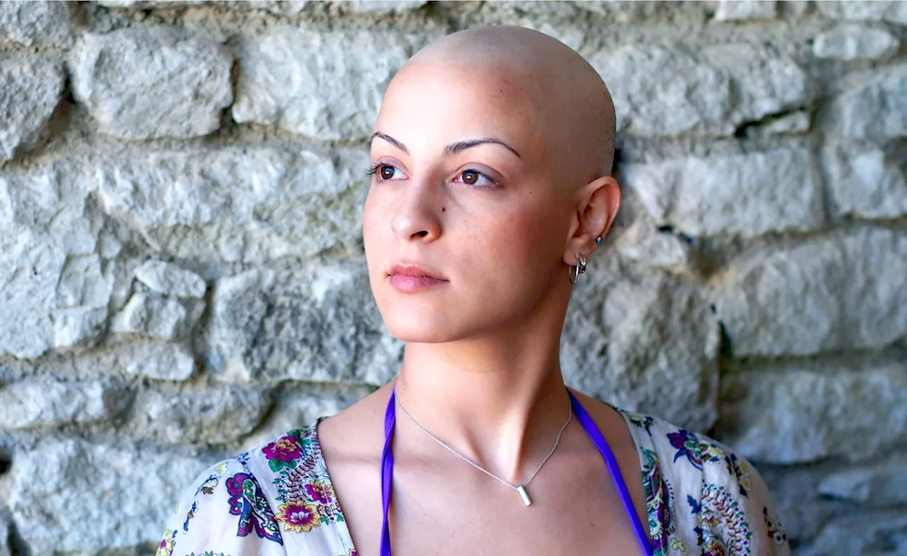 Bald women