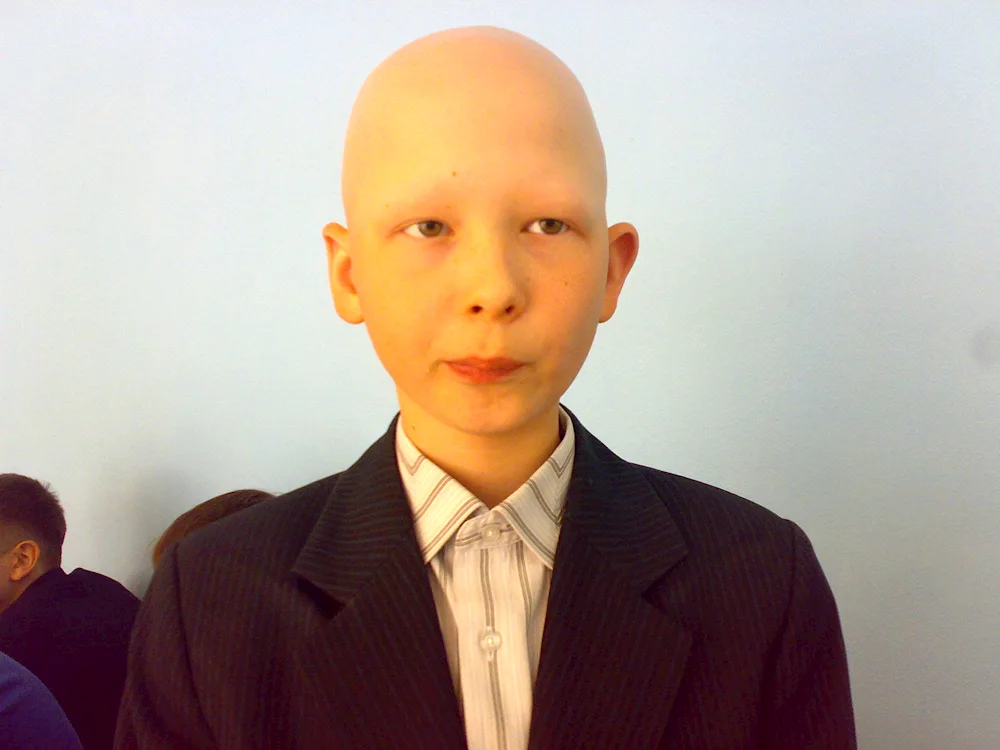Bald boy bald