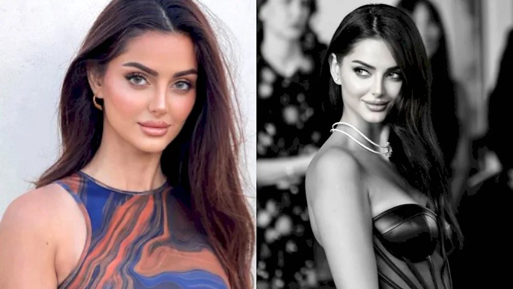 Mahlaga Jaberi modelMahlaga Jaberi modelMahlaga Jaberi modelMahlaga JaberiMahlaga JaberiMahlaga JaberiMahlaga JaberiMahlaga JaberiMahlaga Jaberi before plastic surgery