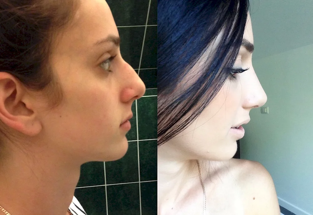 Gal Gadot humped nose