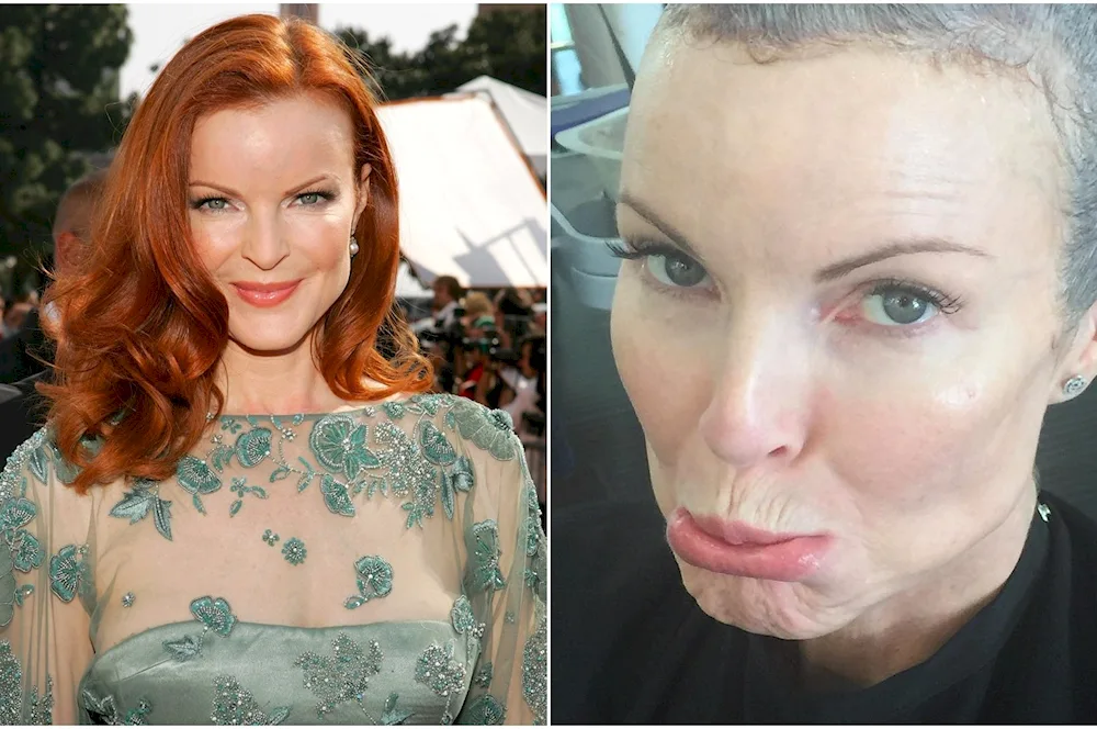 Marcia cross