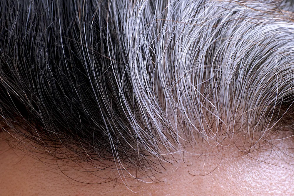 Daphne Hicks Grey hair