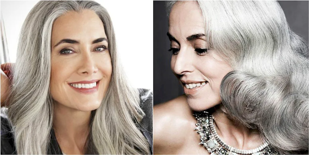 Kate Middleton Grey hair