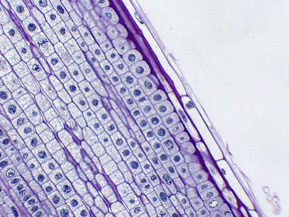 Microphotograph of an onion root