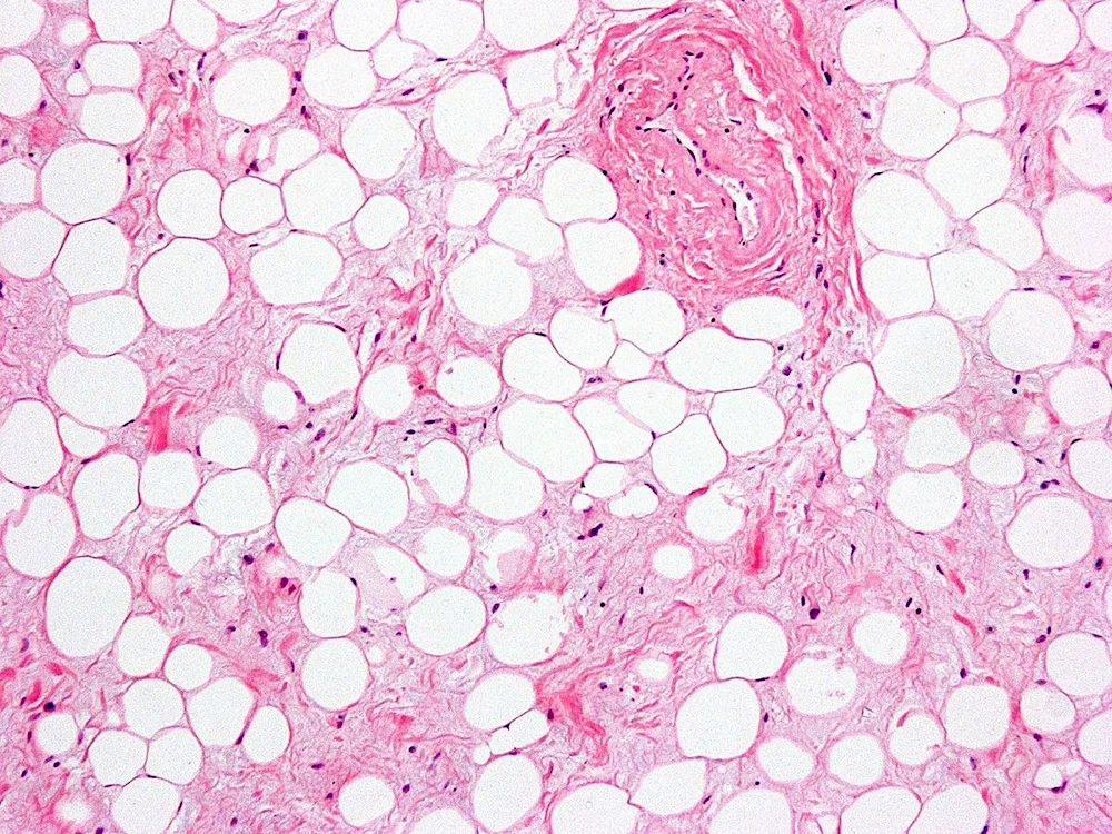 Tigrolysis histology