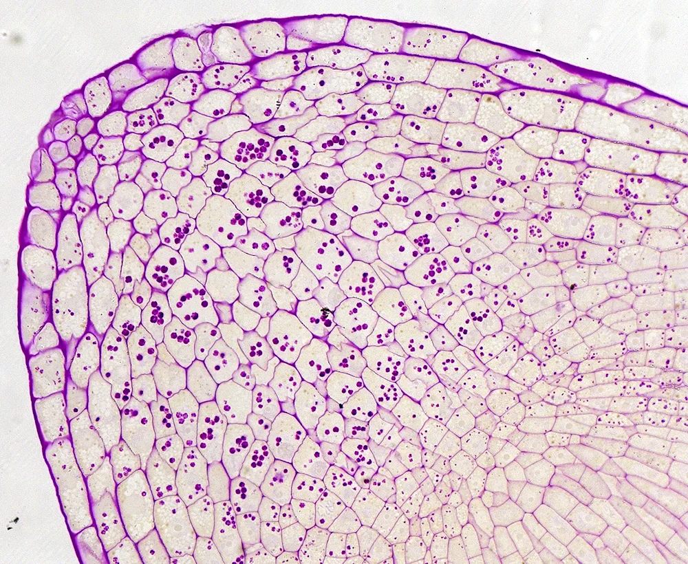 Microdissection of plant tissue