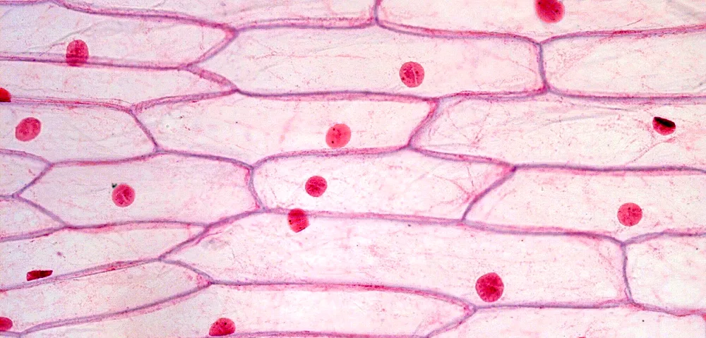 Sphagnum leaf cells