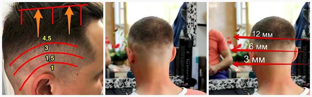 Millimetres of hair on head
