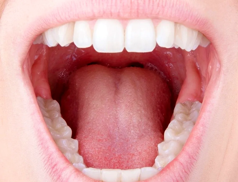 Healthy man's tonsils photo