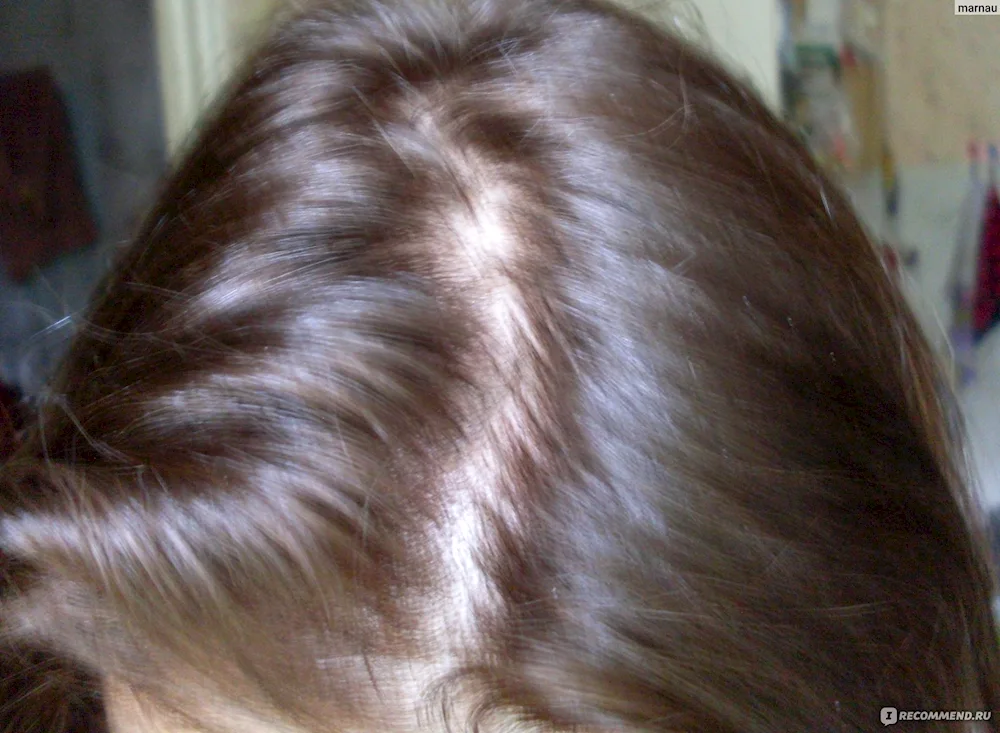 Frosted Chestnut Estelle Dye