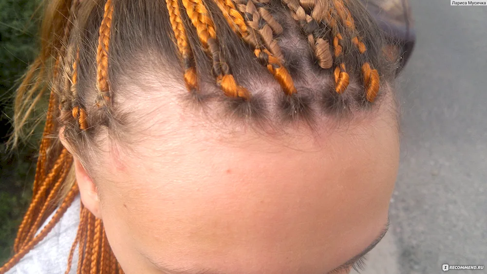 Can Afro braids make your head itchy?