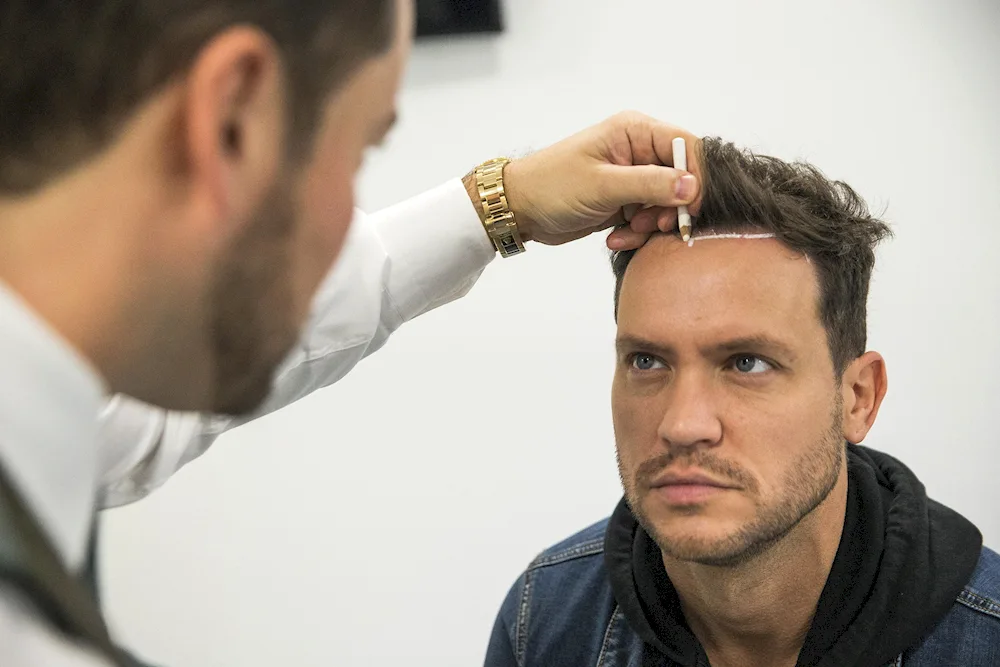 Men's hairstyles with bald patches