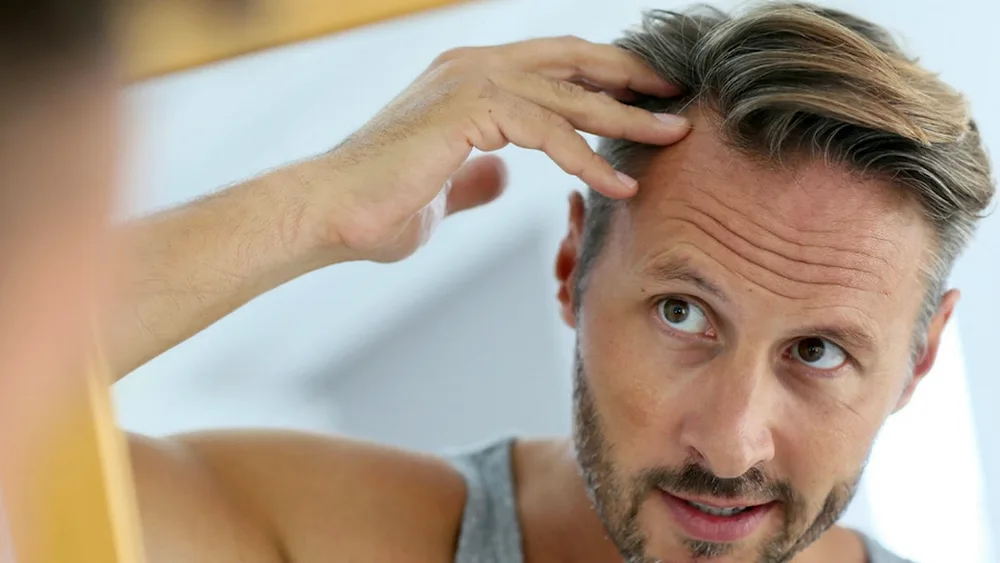 Hairstyles with baldness on the top of the head