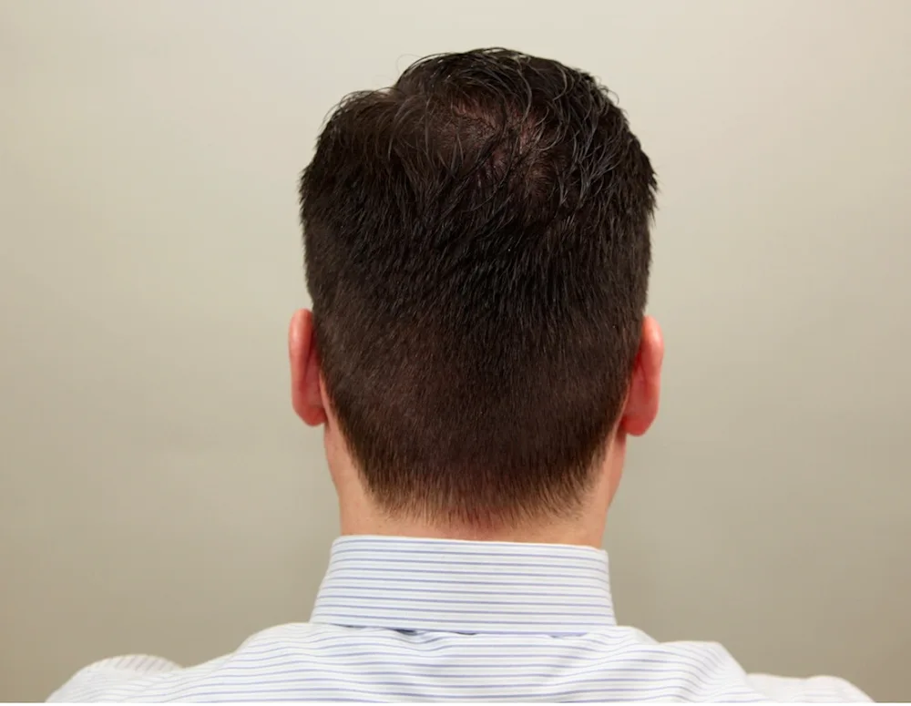 Men's Neck