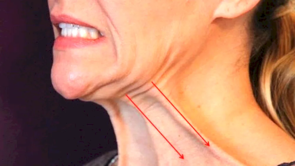 Woman arthritis