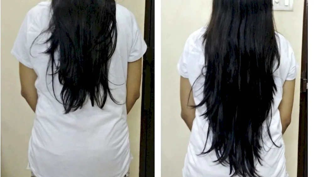 Hair extensions