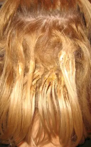 Hair extensions