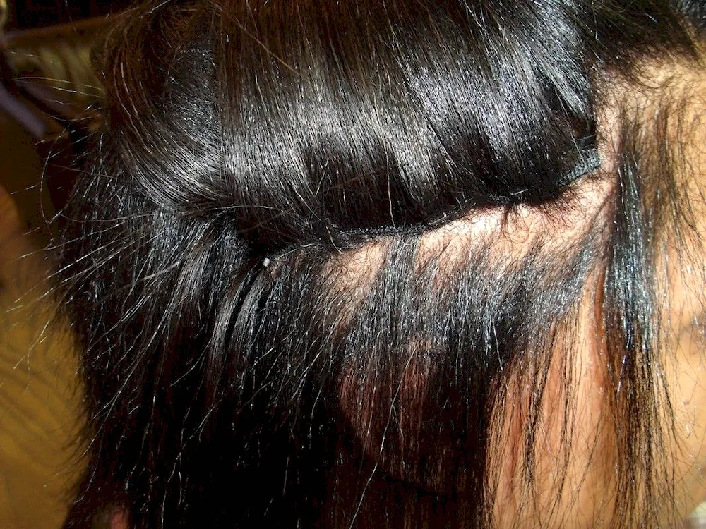 Hair extensions