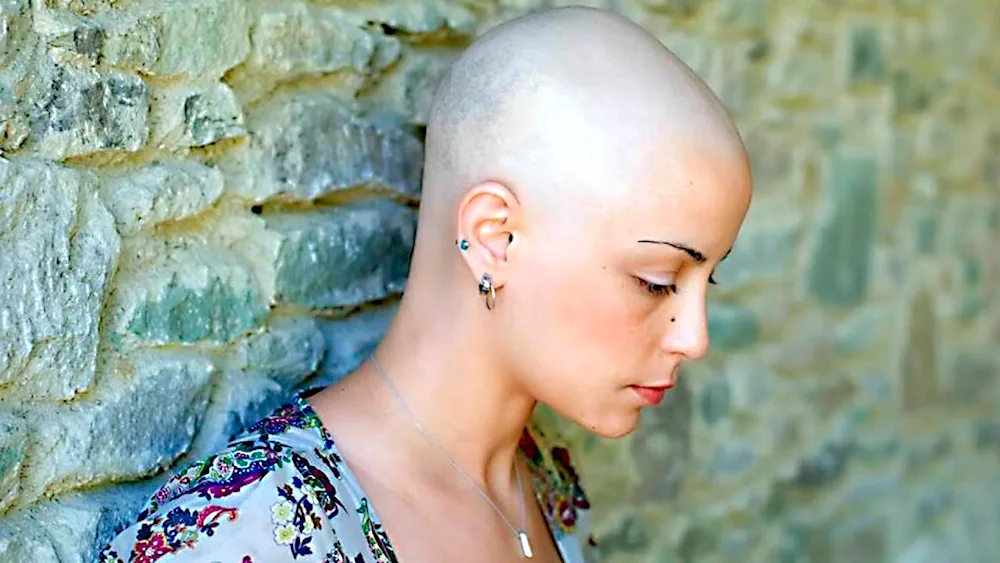 Natasha Whiteman bald