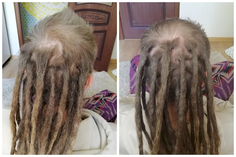 Natural dreadlocks