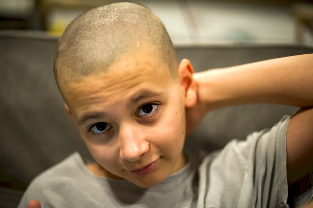 Nazin Nikita bald
