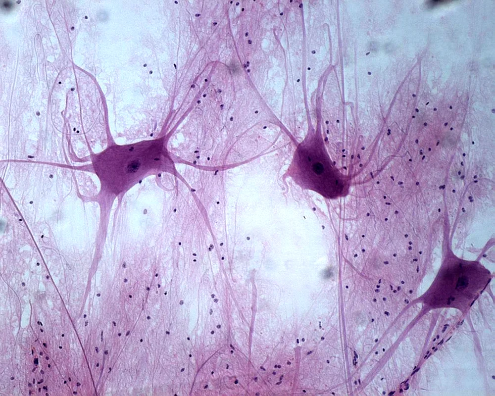 Bone tissue microdissection