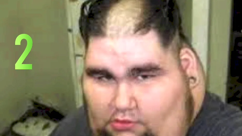 Unfair fringes photo