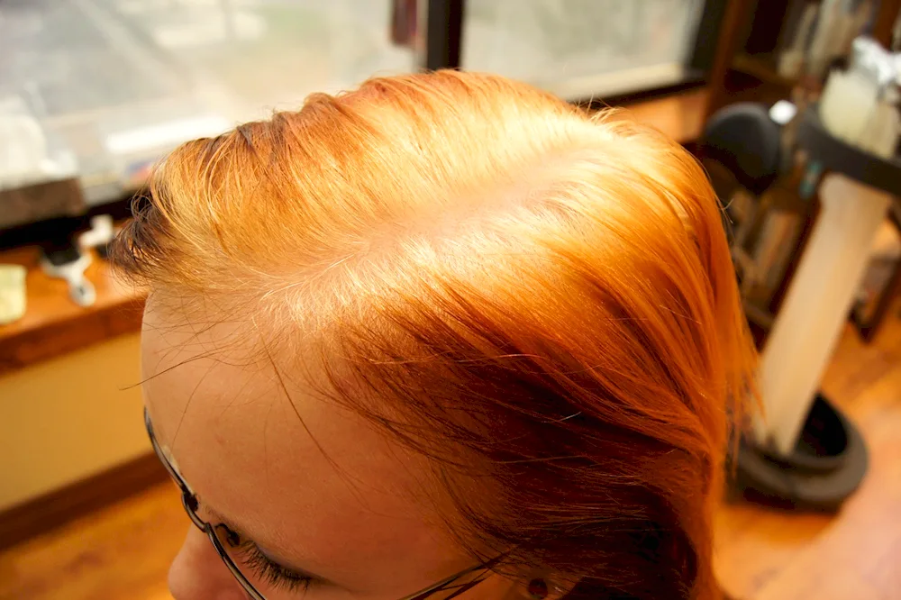 Unsuccessful hair colouring