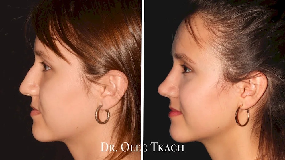 Maria Valverde humped nose in profile