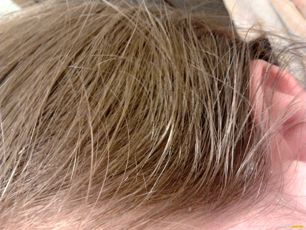 Lemon acid hair rinse