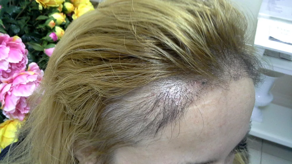 Keune 2000 Superblond