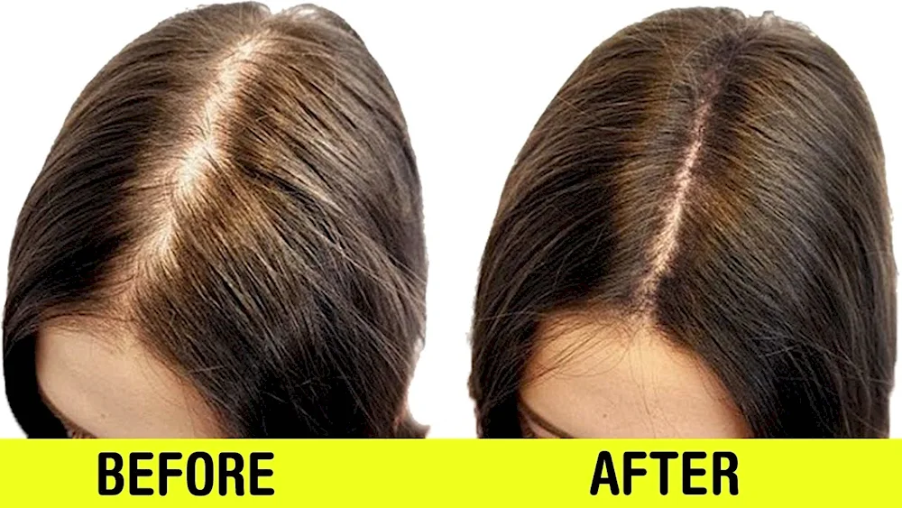 Women's head parting before and after