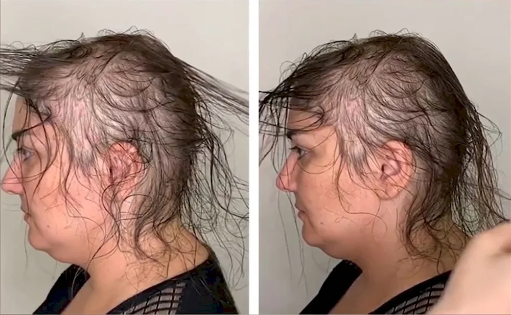 Beautiful hair