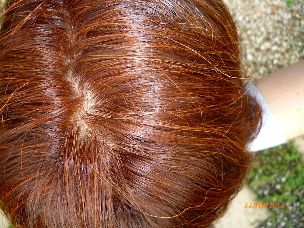 Hnna dyes grey hair