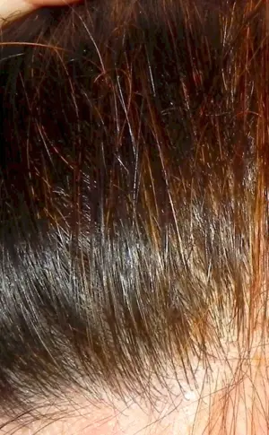 Hair dyeing with henna