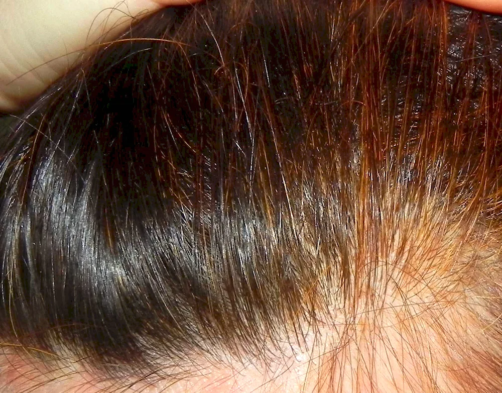 Hair dyeing with henna