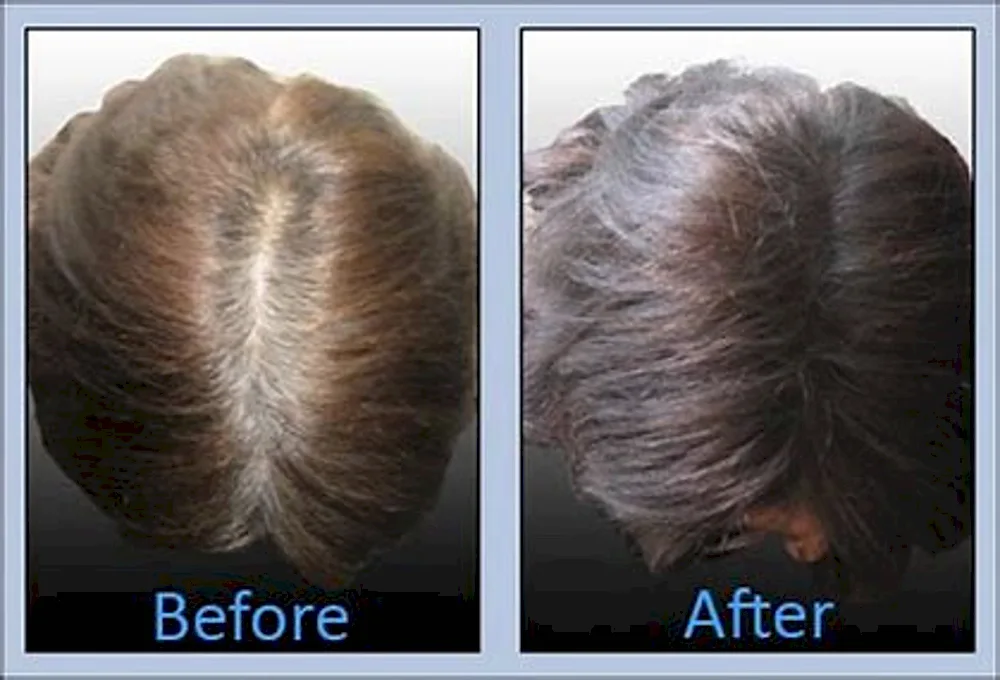 The undercoat on women's heads