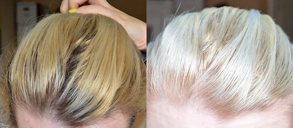 Lemon for hair
