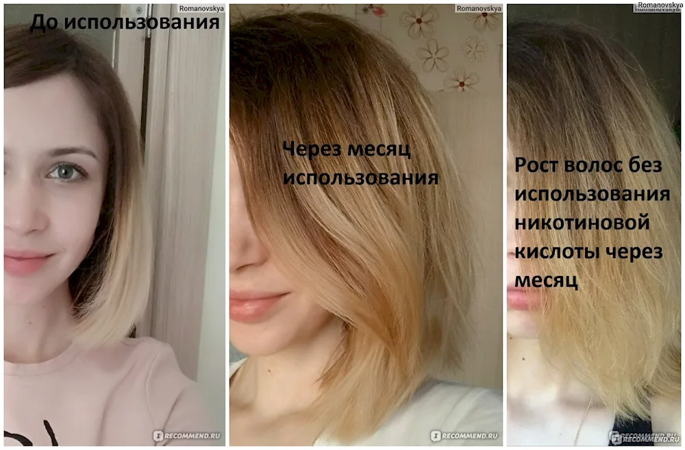 Boost up perm