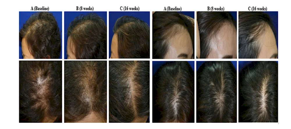 Growing Hair by Months