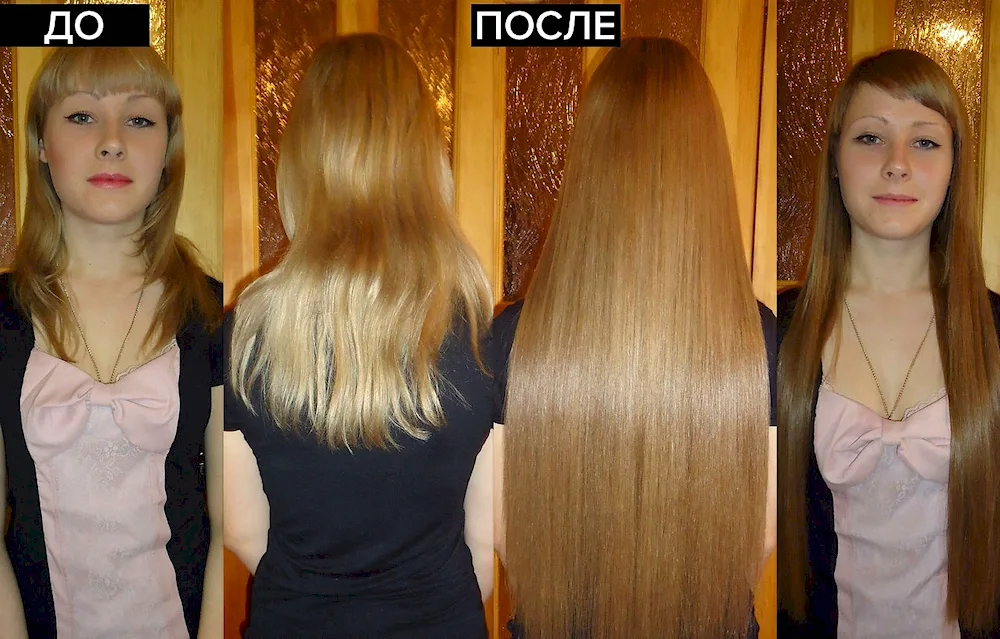 Grew Hair Before and After