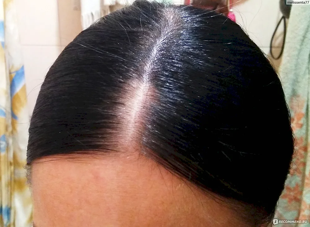 Faded roots